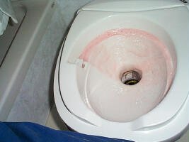 Operate the toilet valve or step pedal ...